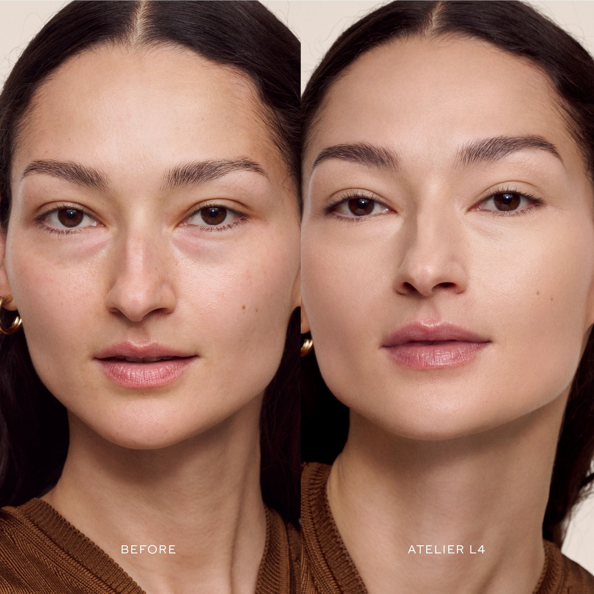 Vital Skincare Concealer