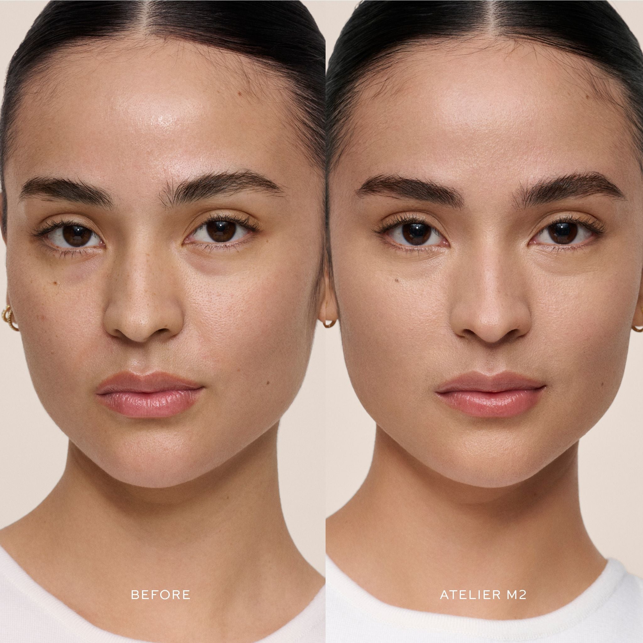 Vital Skincare Concealer