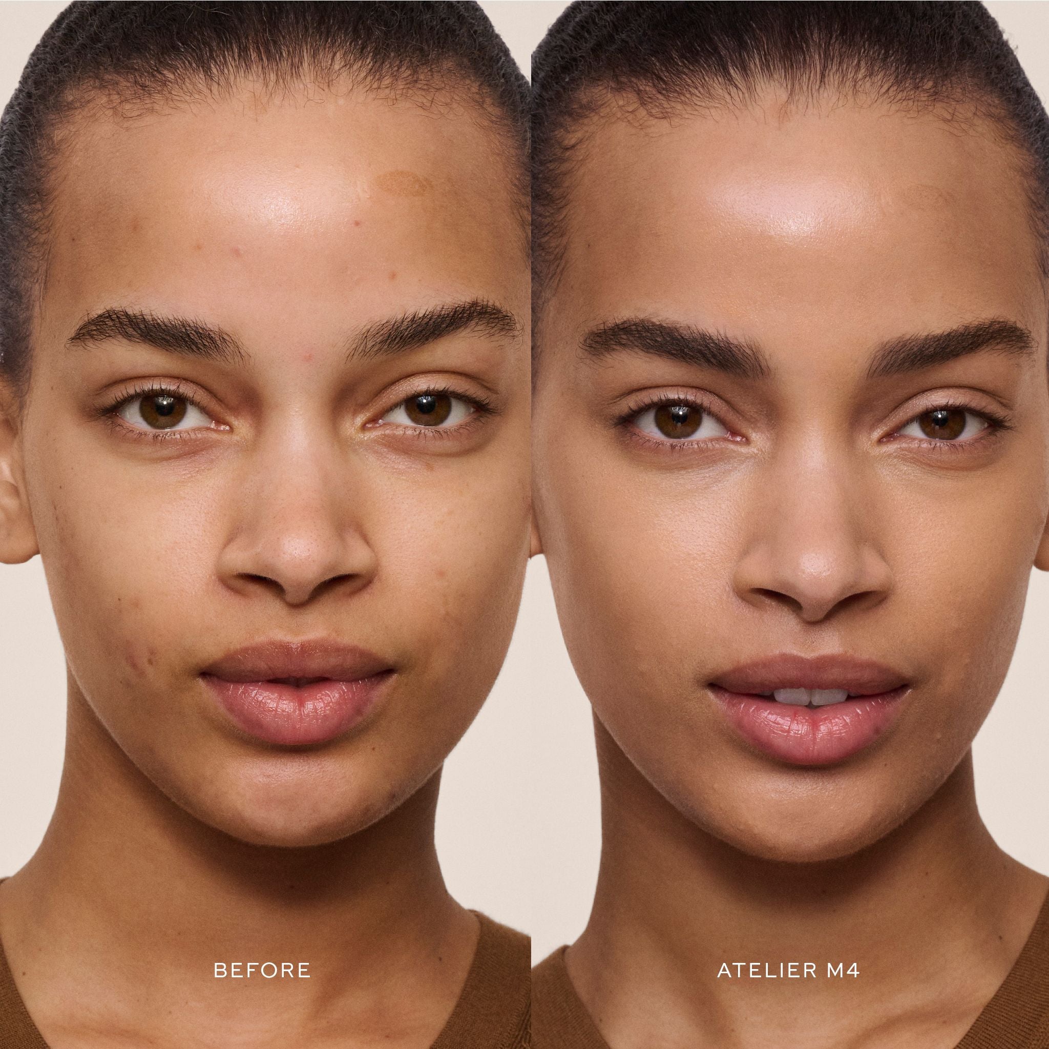 Vital Skincare Concealer