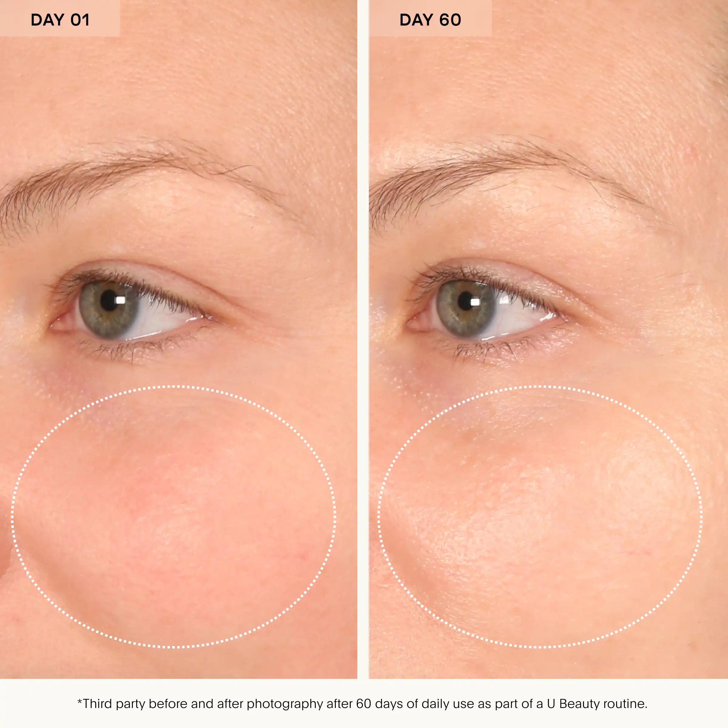Die Bioactive Barrier-Behandlung