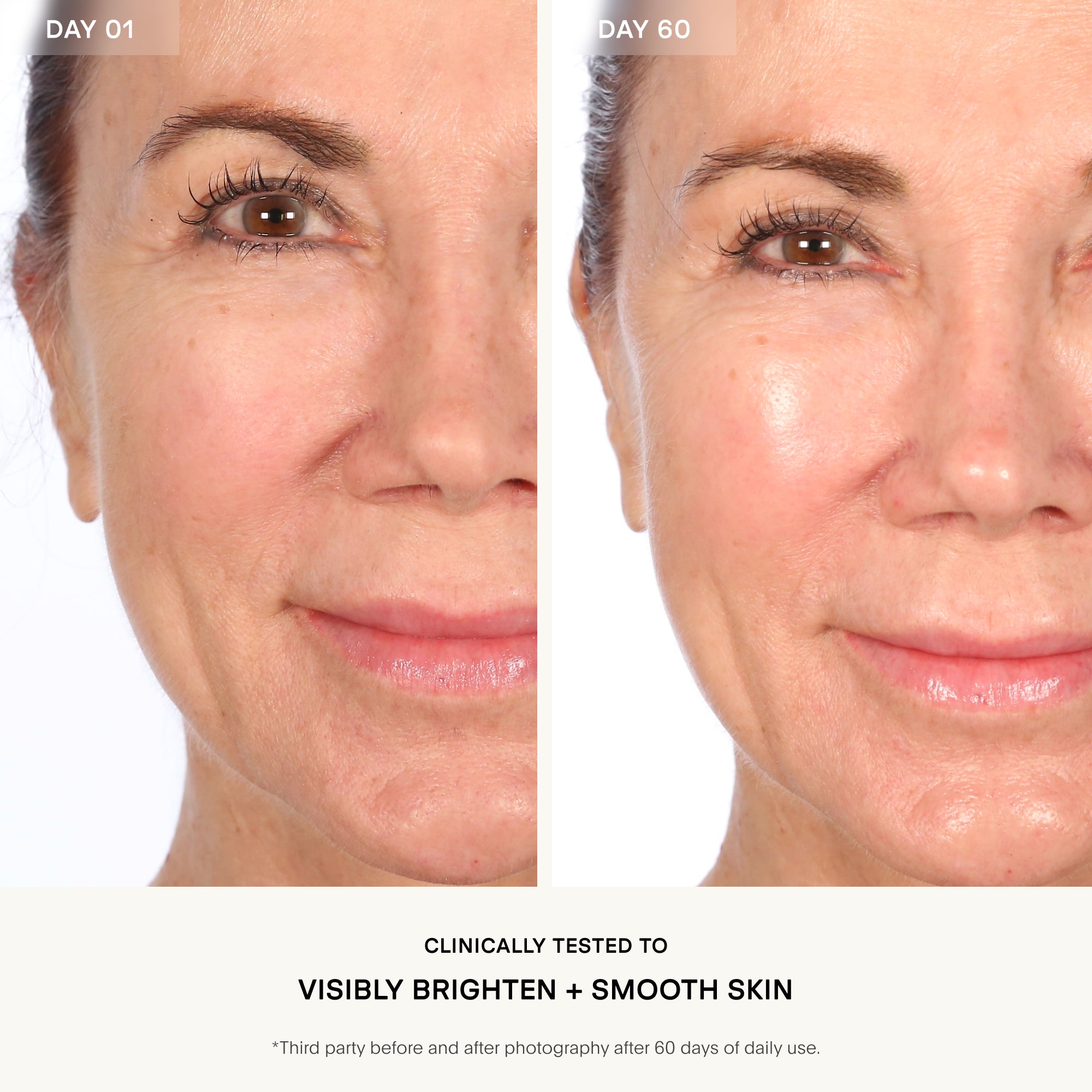 Flash Peel Resurfacing